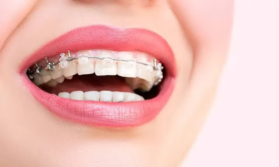 افضل 33 دكتور تجميل اسنان في مصر وكبار خبراء التقويم
